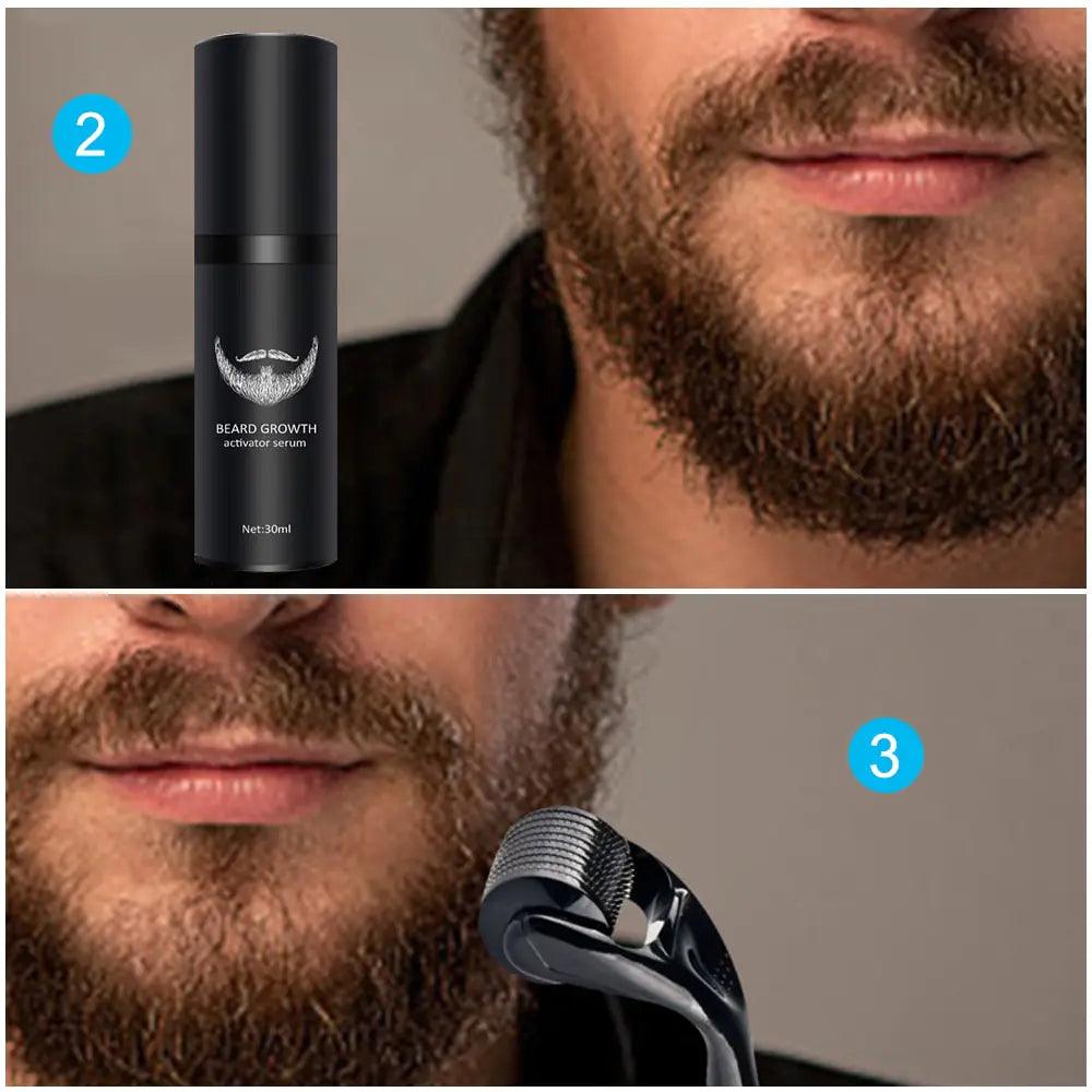 Ultimate Beard Growth Essentials Kit - Inside The Bars
