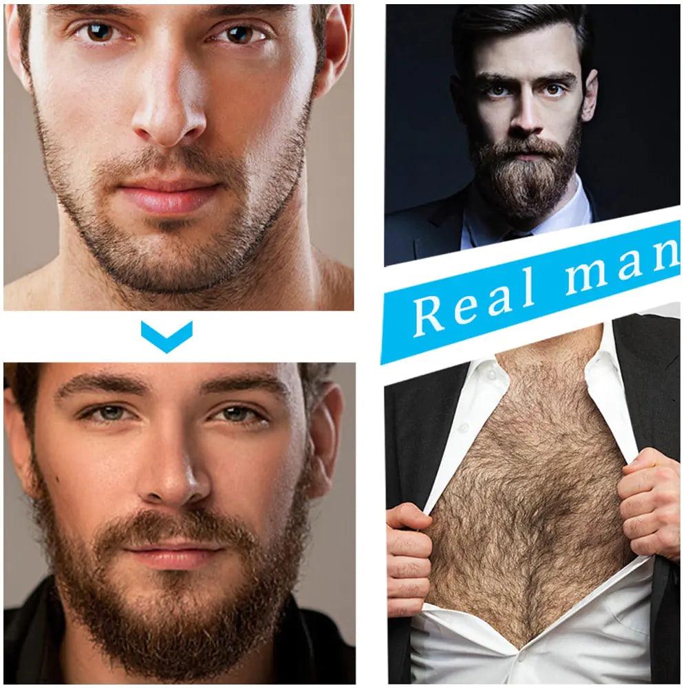 Ultimate Beard Growth Essentials Kit - Inside The Bars